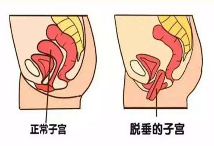 6cca6078948d4d6c499d51213b6487a9.png